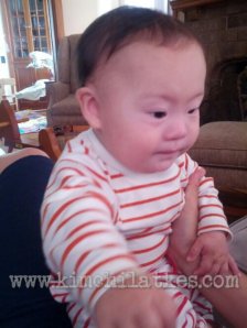 My comb over was more dramatic until my parents treated my thyroid deficiency.  What a lost opportunity.